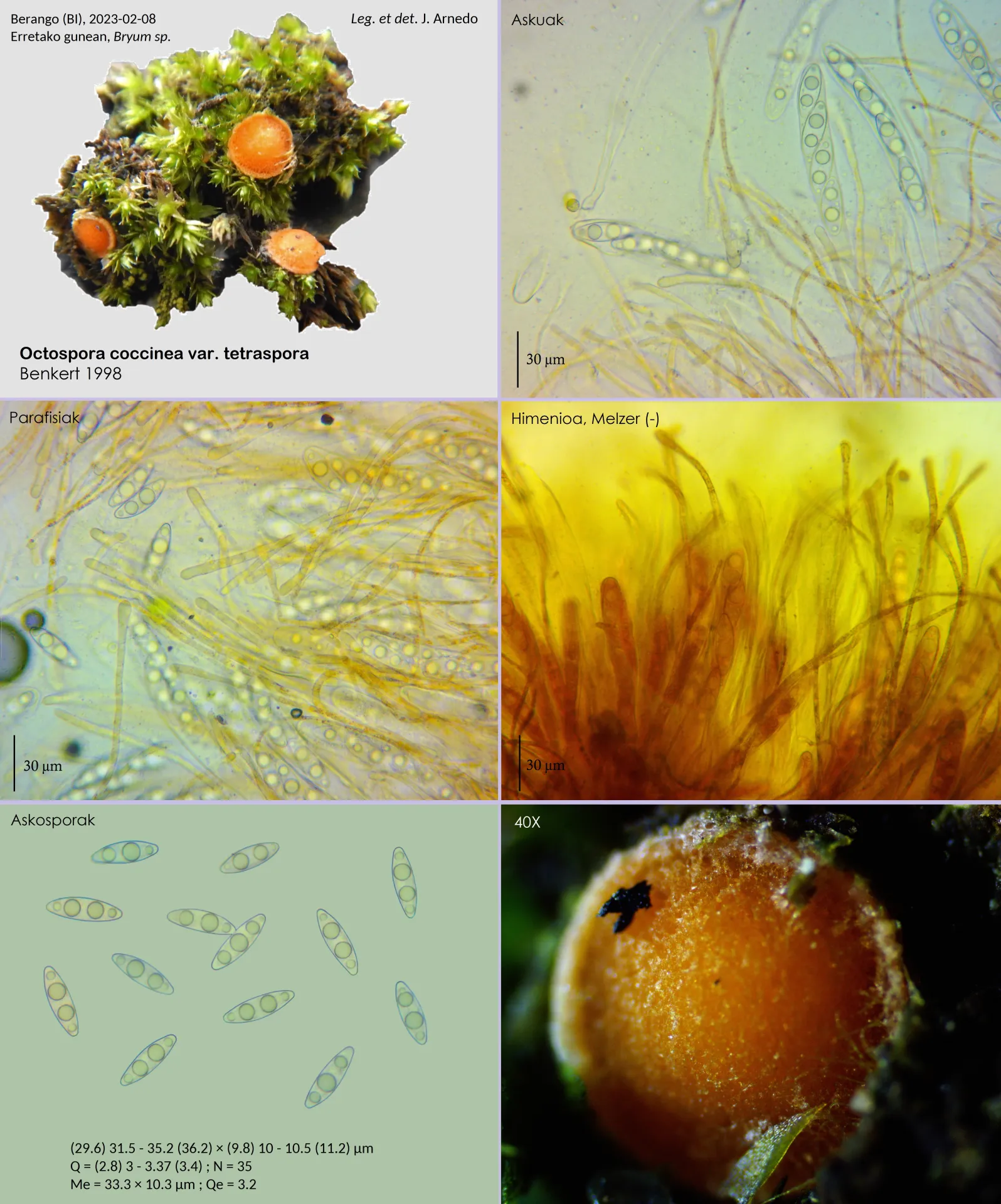 Microscopía de Octospora coccinea var. tetraspora